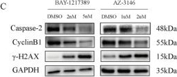 Fig.6.C showing Western Blotting in a Homo sapiens (Human) sample from the publication: NFYA-Mediated TTK Up-Regulation Drives Fast Cell Cycle Progression and Its Inhibition Leads to Mitotic Catastrophe in Triple Negative Breast Cancer.