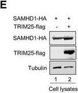 Fig.2.E showing Western Blotting in a Mus musculus (House mouse) sample from the publication: TRIM21-mediated proteasomal degradation of SAMHD1 regulates its antiviral activity.