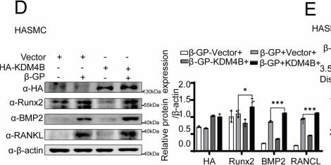 Fig.6.D showing Western Blotting from the publication: KDM4B modulates ERα signaling pathway to participate in vascular smooth muscle cell calcification.