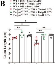 Fig.7.B from the publication: Decreased TMIGD1 aggravates colitis and intestinal barrier dysfunction via the BANF1-NF-κB pathway in Crohn's disease.