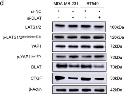 Fig.4.D showing Western Blotting in a Homo sapiens (Human) sample from the publication: DLAT promotes triple-negative breast cancer progression via YAP1 activation.