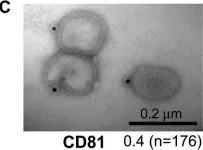 Fig.5.C showing Immunocytochemistry in an Influenza A virus (A/Taiwan/01/1986(H1N1)) sample from the publication: Cellular proteins in influenza virus particles.