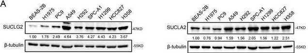 Fig.1.A showing Western Blotting in a Homo sapiens (Human) sample from the publication: SUCLG2 Regulates Mitochondrial Dysfunction through Succinylation in Lung Adenocarcinoma.