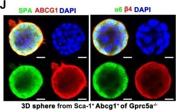 Fig.5.J showing Immunocytochemistry-immunofluorescence in a Mus musculus (House mouse) sample from the publication: Identification of Sca-1+Abcg1+ bronchioalveolar epithelial cells as the origin of lung adenocarcinoma in Gprc5a-knockout mouse model through the interaction between lung progenitor AT2 and Lgr5 cells.