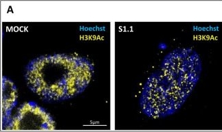 Fig.3.A showing Immunocytochemistry-immunofluorescence in a Homo sapiens (Human) sample from the publication: Epigenome and three-dimensional genome architecture remodeling during NDM29-mediated retro-transformation of neuroblastoma cells.