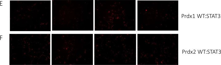 Fig.5.E showing Immunocytochemistry-immunofluorescence in a Homo sapiens (Human) sample from the publication: Prdx1 Interacts with ASK1 upon Exposure to H2O2 and Independently of a Scaffolding Protein.