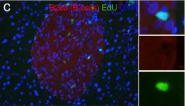 Fig.9.C showing Western Blotting in a Mus musculus (House mouse) sample from the publication: Resolving Discrepant Findings on ANGPTL8 in β-Cell Proliferation: A Collaborative Approach to Resolving the Betatrophin Controversy.