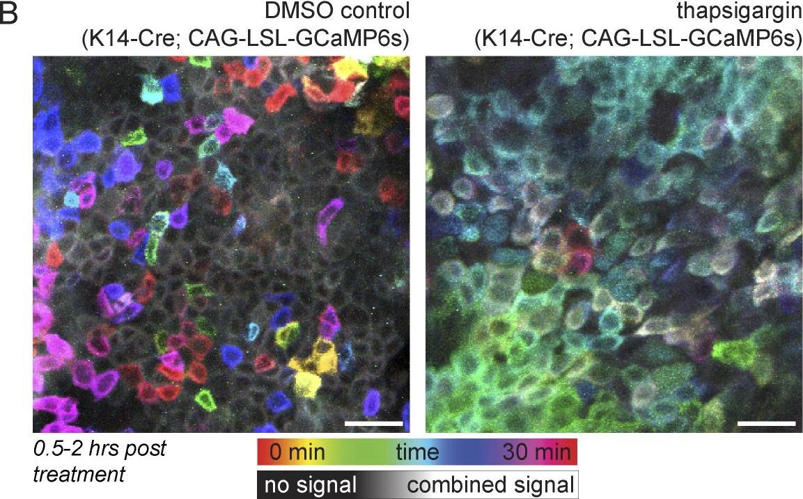 Cell cycle controls long-range calcium signaling in the regenerating epidermis.