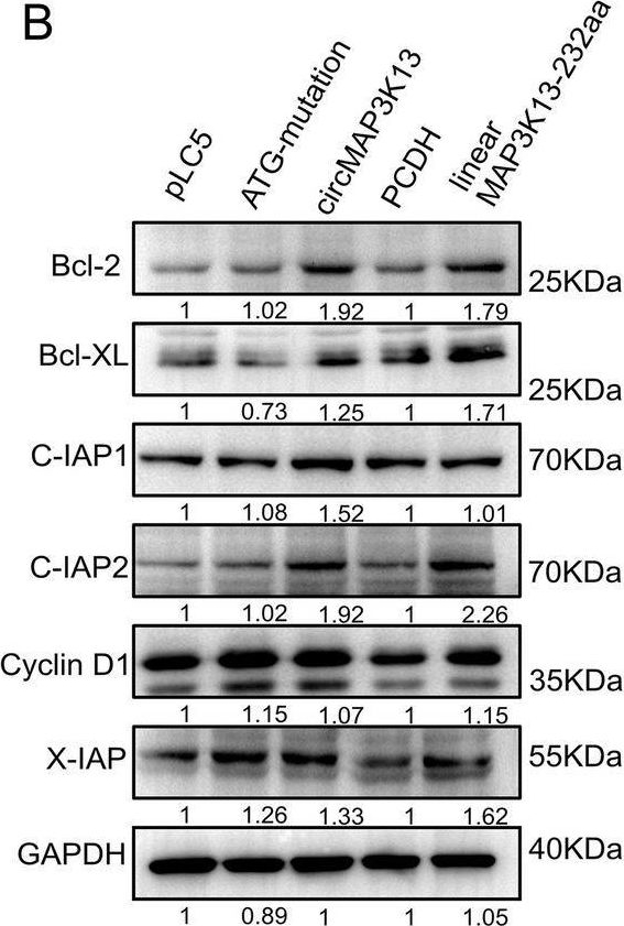 Fig.7.B showing Western Blotting in a Homo sapiens (Human) sample from the publication: MAP3K13-232aa encoded by circMAP3K13 enhances cisplatin-induced pyroptosis by directly binding to IKKα in gastric adenocarcinoma.