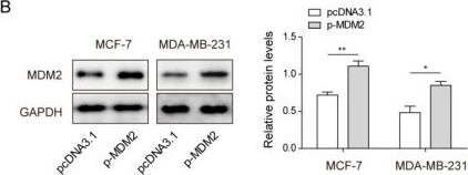 Fig.5.B showing Western Blotting in a Homo sapiens (Human) sample from the publication: ZLM-7 Blocks Breast Cancer Progression by Inhibiting MDM2 via Upregulation of 14-3-3 Sigma.