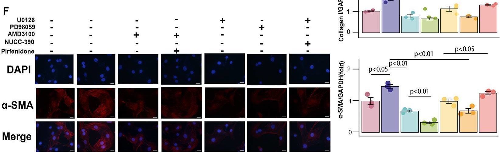 Fig.6.F from the publication: Multiomic analysis of monocyte-derived alveolar macrophages in idiopathic pulmonary fibrosis.