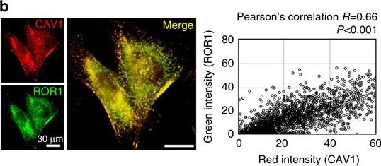 Fig.3.B showing Immunocytochemistry-immunofluorescence in a Homo sapiens (Human) sample from the publication: ROR1 sustains caveolae and survival signalling as a scaffold of cavin-1 and caveolin-1.