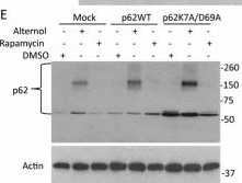 Fig.4.E showing Western Blotting from the publication: Alternol-Induced Oxidative Modification of SQSTM1/p62 Is Associated with Nrf2 Signaling and Autophagy-Related Responses in Prostate Cancer Cells.