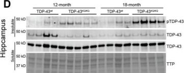 トップス ans dotsloevner TDP43 (D9R3L) Rabbit Monoclonal Antibody | Cell Signaling Technology