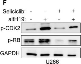 Fig.7.F showing Western Blotting in a Homo sapiens (Human) sample from the publication: LncRNA H19-Encoded Micropeptide altH19 Promotes DNA Replication and Mitosis in Myeloma Cells by Enhancing the Phosphorylation of CDK2 at Threonine 160.