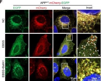 Fig.4.F showing Immunocytochemistry-immunofluorescence from the publication: FAM134B-mediated ER-phagy degrades APP and suppresses Alzheimer's disease pathology.