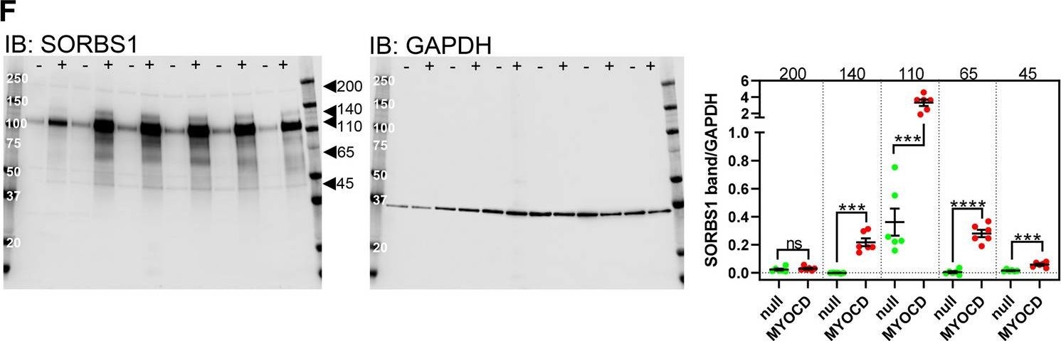 Fig.5.F showing Western Blotting in a Homo sapiens (Human) sample from the publication: Myocardin regulates exon usage in smooth muscle cells through induction of splicing regulatory factors.