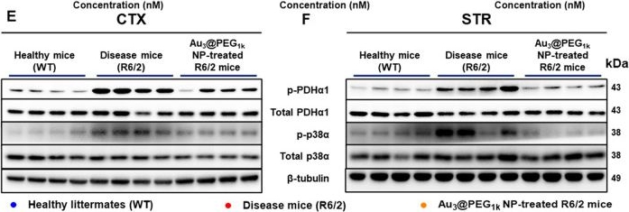 Fig.5.E showing Western Blotting in a Mus musculus (House mouse) sample from the publication: Small Gold Nanoparticles Alleviate Huntington's Disease via Modulating p38α Mitogen-Activated Protein Kinase and Pyruvate Dehydrogenase Kinase 1.