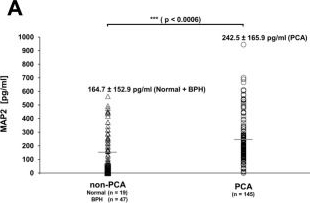 Fig.7.A showing Enzyme-linked immunosorbent assay from the publication: Expression of the microtubule-associated protein 2 (MAP2) as a potential independent prognostic marker in prostate cancer.