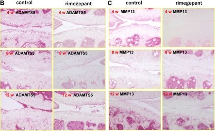 Fig.2.B showing Immunohistochemistry from the publication: Feasibility of administration of calcitonin gene-related peptide receptor antagonist on attenuation of pain and progression in osteoarthritis.