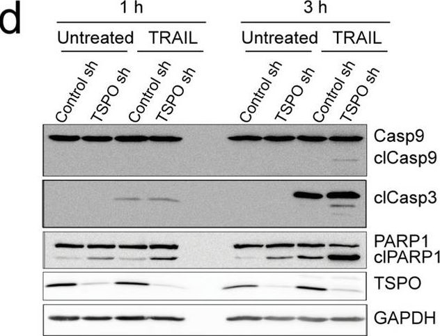 Fig.5.D showing Western Blotting in a Mus musculus (House mouse) sample from the publication: TSPO acts as an immune resistance gene involved in the T cell mediated immune control of glioblastoma.