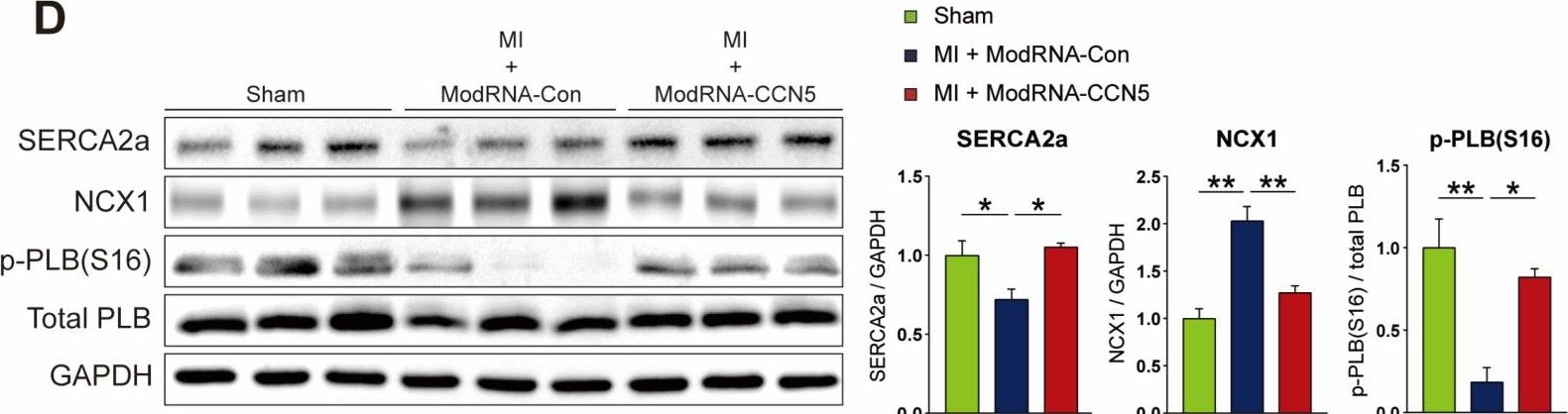 Fig.2.D showing Western Blotting from the publication: Modified mRNA-Mediated CCN5 Gene Transfer Ameliorates Cardiac Dysfunction and Fibrosis without Adverse Structural Remodeling.