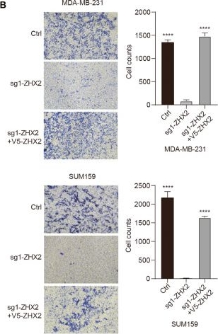 Fig.4.B showing Immunohistochemistry in a Homo sapiens (Human) sample from the publication: ZHX2 deficiency enriches hybrid MET cells through regulating E-cadherin expression.