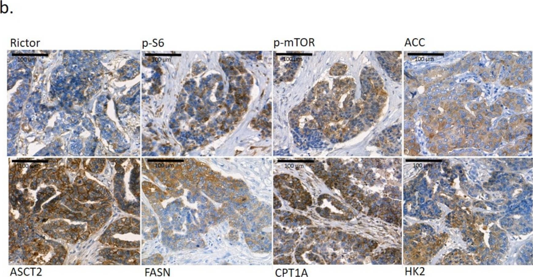 Fig.1.B showing Immunohistochemistry in a Homo sapiens (Human) sample from the publication: Characterisation of 3D Bioprinted Human Breast Cancer Model for In Vitro Drug and Metabolic Targeting.