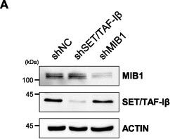 Fig.7.A showing Western Blotting in a Homo sapiens (Human) sample from the publication: INHAT subunit SET/TAF-Iβ regulates PRC1-independent H2AK119 mono-ubiquitination via E3 ligase MIB1 in colon cancer.