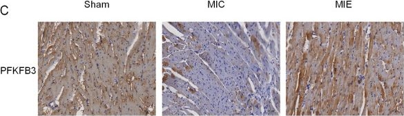 Fig.6.C showing Immunohistochemistry in a Rattus norvegicus (Rat) sample from the publication: Effect of exercise training on cardiac function and glucose metabolism in the ischemic border zone: insights from multi-modal imaging techniques.