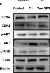 Fig.3.G showing Western Blotting in a Mus musculus (House mouse) sample from the publication: Ginseng Polysaccharides Protect Against Endoplasmic Reticulum Stress-Induced Damage via PI3K/Akt Signalling Pathway in Bovine Ovarian Granulosa Cells.