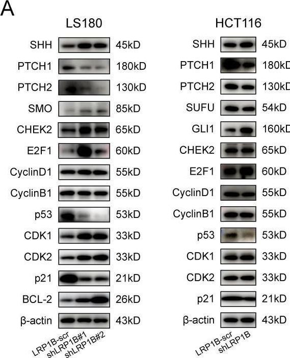 Fig.7.A showing Western Blotting in a Homo sapiens (Human) sample from the publication: Molecular characteristics and cancer immunity of LRP1B and its relationship with the Hedgehog signaling pathway in colorectal cancer.