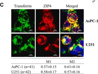 Fig.3.C showing Immunocytochemistry-immunofluorescence in a Homo sapiens (Human) sample from the publication: Zinc-induced exposure of an LxL motif drives clathrin-mediated endocytosis of the zinc transceptor ZIP4.