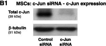 Fig.6.B showing Enzyme-linked immunosorbent assay in a Homo sapiens (Human) sample from the publication: Regulation of the inflammatory profile of stromal cells in human breast cancer: prominent roles for TNF-α and the NF-κB pathway.