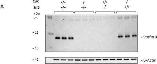 Fig.1.A showing Western Blotting in a Mus musculus (House mouse) sample from the publication: Stefin B and Cystatin C Deficiency Suppresses Tumor Growth and Alters Tumor Microenvironment in a Breast Cancer Model.