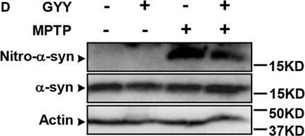 Fig.4.D showing Western Blotting in a Mus musculus (House mouse) sample from the publication: GYY4137, an H2S Slow-Releasing Donor, Prevents Nitrative Stress and α-Synuclein Nitration in an MPTP Mouse Model of Parkinson's Disease.