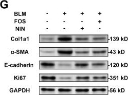 Fig.6.G showing Western Blotting from the publication: Identification of senescence-related genes in diagnosing idiopathic pulmonary fibrosis via integrating bioinformatics analysis and machine learning.