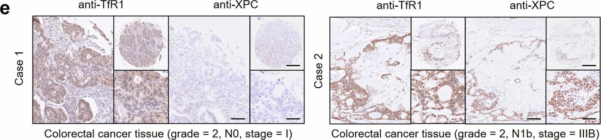 Fig.6.E showing Immunohistochemistry in a Mus musculus (House mouse) sample from the publication: Transferrin receptor 1 nuclear translocation facilitates tumor progression via p53-mediated chromatin interactions and genome-wide alterations.