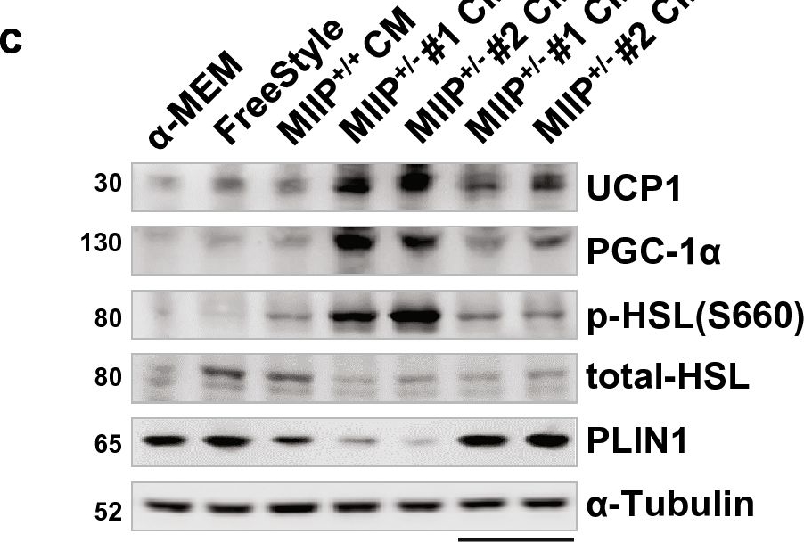 Fig.2.C showing Western Blotting in a Homo sapiens (Human) sample from the publication: MIIP downregulation drives colorectal cancer progression through inducing peri-cancerous adipose tissue browning.