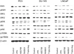 Fig.8.A showing Western Blotting in a Homo sapiens (Human) sample from the publication: Molecular targeting of prostate cancer cells by a triple drug combination down-regulates integrin driven adhesion processes, delays cell cycle progression and interferes with the cdk-cyclin axis.