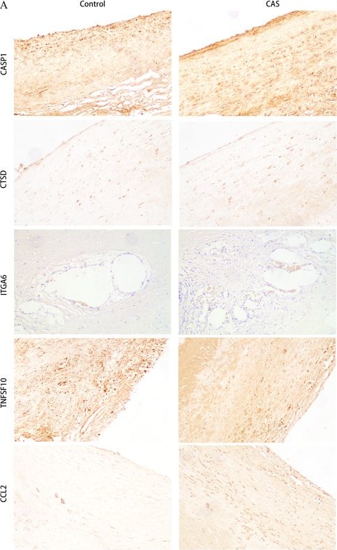 Fig.3.A showing Immunohistochemistry from the publication: Comprehensive analysis of autophagy-related gene expression profiles identified five gene biomarkers associated with immune infiltration and advanced plaques in carotid atherosclerosis.