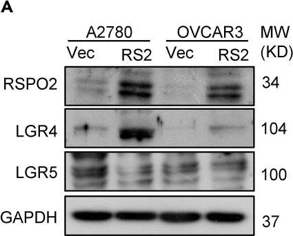 Fig.5.A showing Western Blotting in a Homo sapiens (Human) sample from the publication: RSPO2 promotes progression of ovarian cancer through dual receptor-mediated FAK/Src signaling activation.