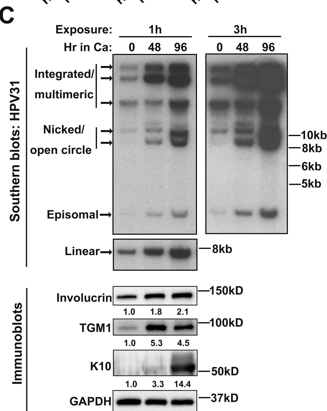 Fig.2.C showing Western Blotting from the publication: KSHV and HPV modulate epithelial-to-mesenchymal transition in oral epithelial cells.