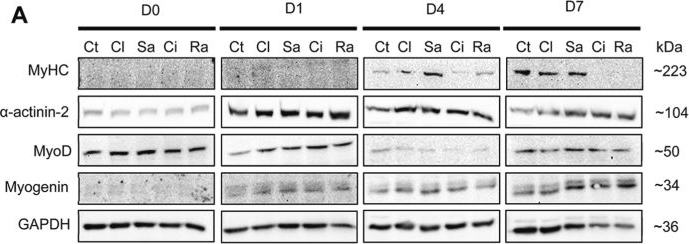 Fig.4.A showing Western Blotting from the publication: Beta-agonist drugs modulate the proliferation and differentiation of skeletal muscle cells in vitro.