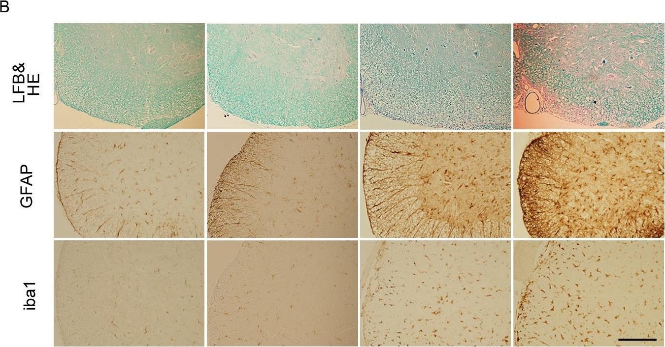 Delayed onset of experimental autoimmune encephalomyelitis in Olig1 deficient mice.