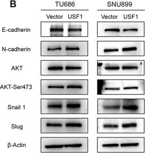 Fig.5.B showing Western Blotting from the publication: LncRNA MIR4435-2HG-mediated succinylation of USF1 promotes its protein stability and induces epithelial-mesenchymal transition in HNSCC.