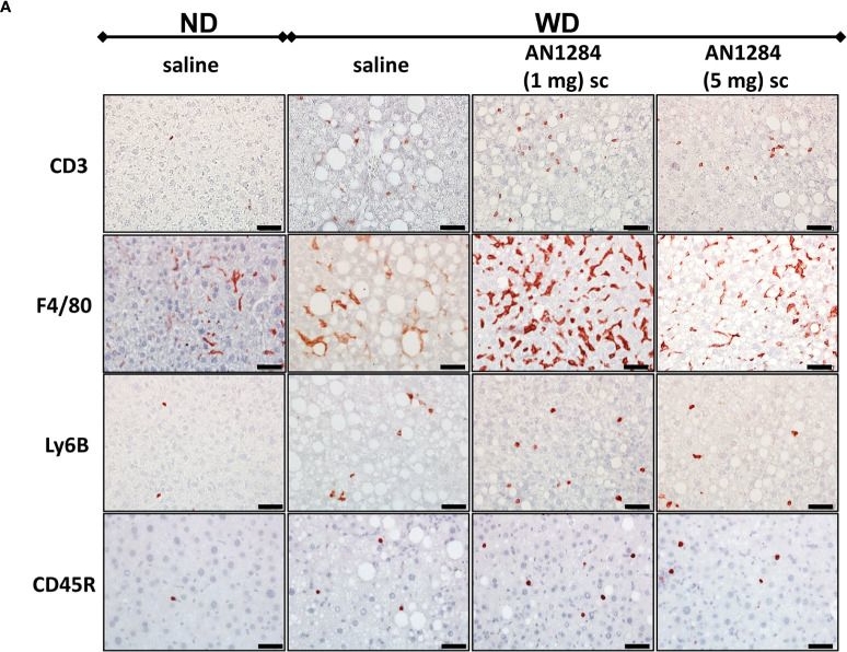 Fig.5.A showing Immunohistochemistry in a Mus musculus (House mouse) sample from the publication: AN1284 attenuates steatosis, lipogenesis, and fibrosis in mice with pre-existing non-alcoholic steatohepatitis and directly affects aryl hydrocarbon receptor in a hepatic cell line.