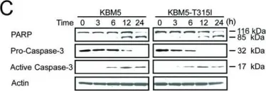 Fig.4.C showing Western Blotting from the publication: Pristimerin induces apoptosis in imatinib-resistant chronic myelogenous leukemia cells harboring T315I mutation by blocking NF-kappaB signaling and depleting Bcr-Abl.