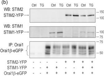 Fig.6.B showing Western Blotting in a Homo sapiens (Human) sample from the publication: Feedback modulation of Orai1α and Orai1β protein content mediated by STIM proteins.