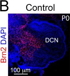 Fig.3.B showing Immunohistochemistry-immunofluorescence in a Mus musculus (House mouse) sample from the publication: Olig3 regulates early cerebellar development.